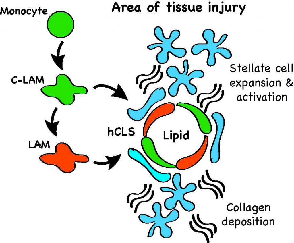  The image depicts the formation of a hepatic crown like structure, including the interaction between C-LAMs, LAMs, and hepatic stellate cells. 